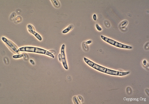 nấm Fusarium oxysporum, Fusarium sp